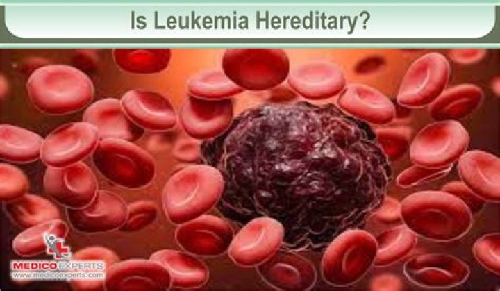 Are acute leukemia hereditary?