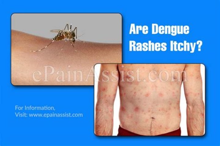 Are dengue rashes itchy?
