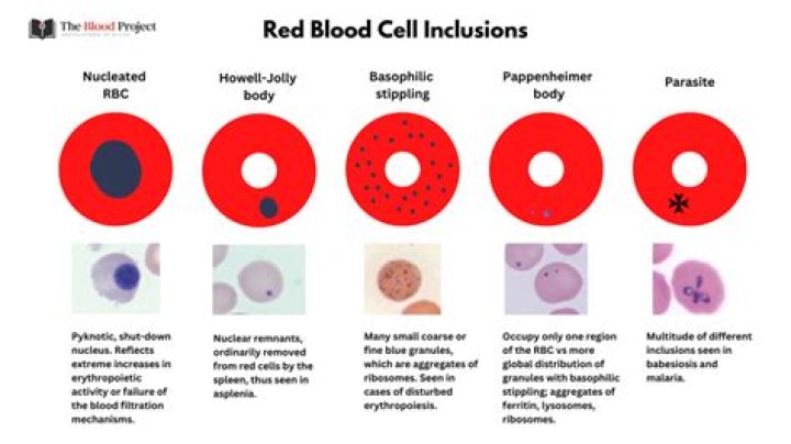 Are inclusions found in all cells?