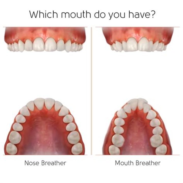 Are mouth breathers stupid?