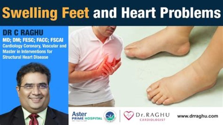 Are sore feet a sign of heart problems?