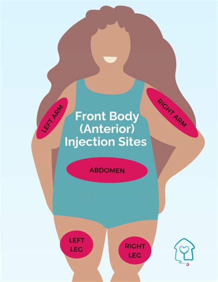 Are you supposed to tip electrologist?