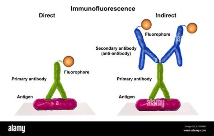 By indirect immunofluorescence technique?