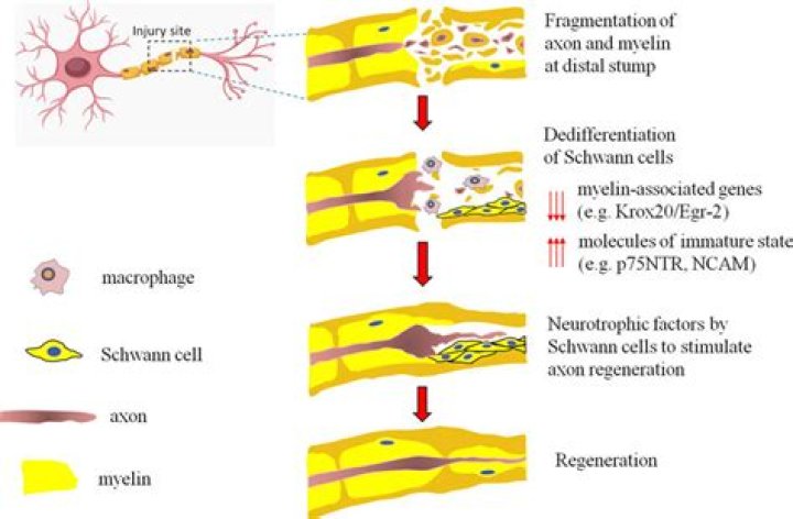 Can damaged axons be repaired?