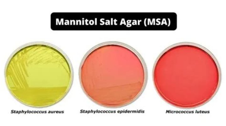 Can e coli ferment mannitol?