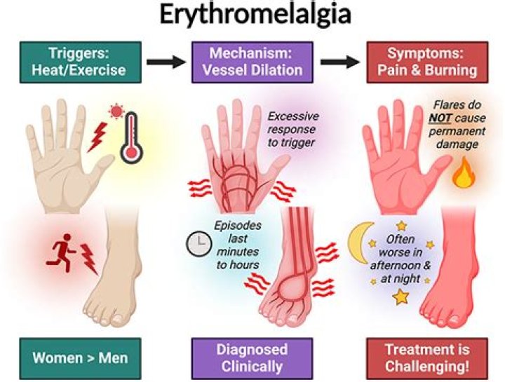 Can erythromelalgia cause numbness?