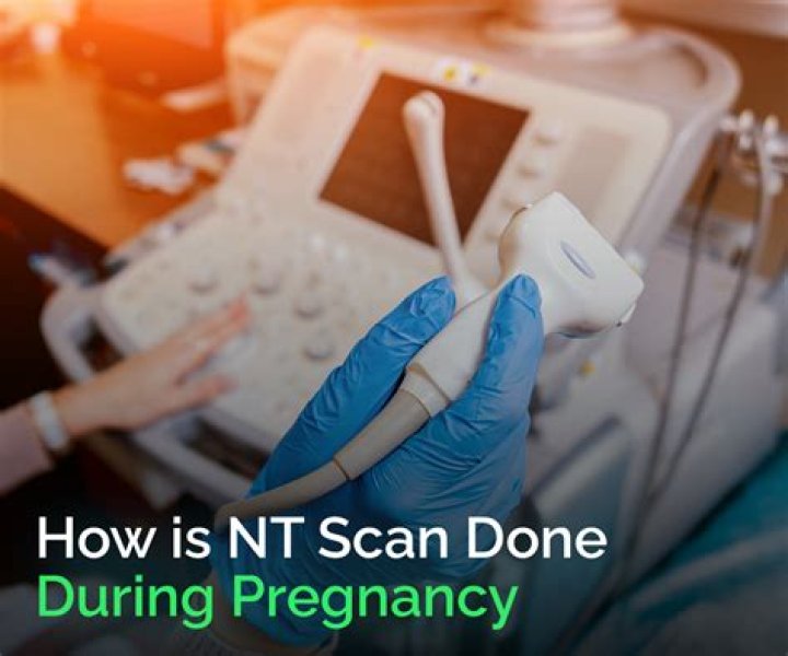 Can nt scan detect autism?