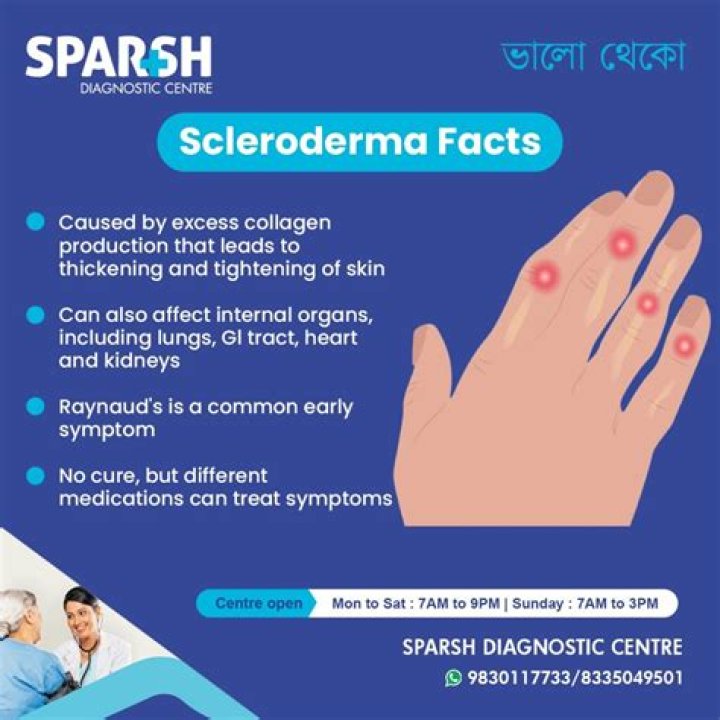 Can you work with scleroderma?