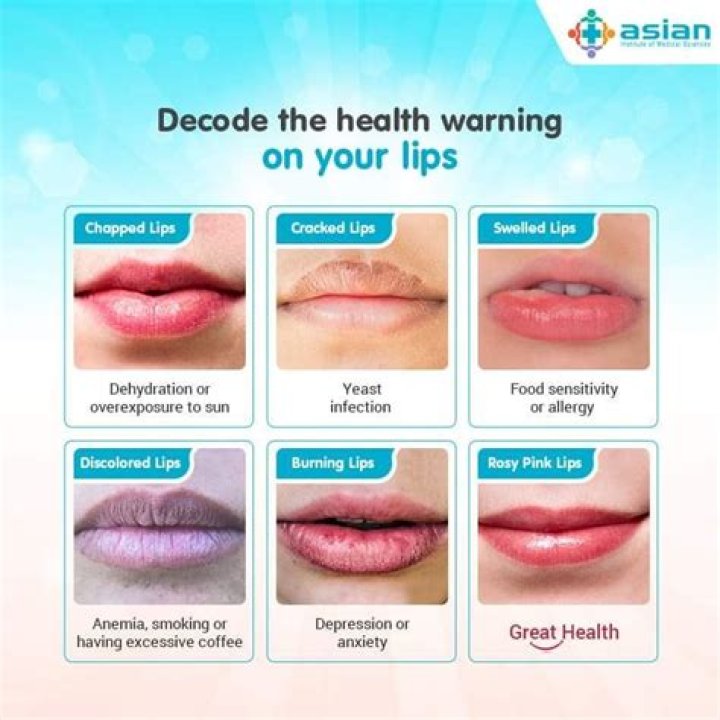 Could cracked lips be a sign of dehydration?