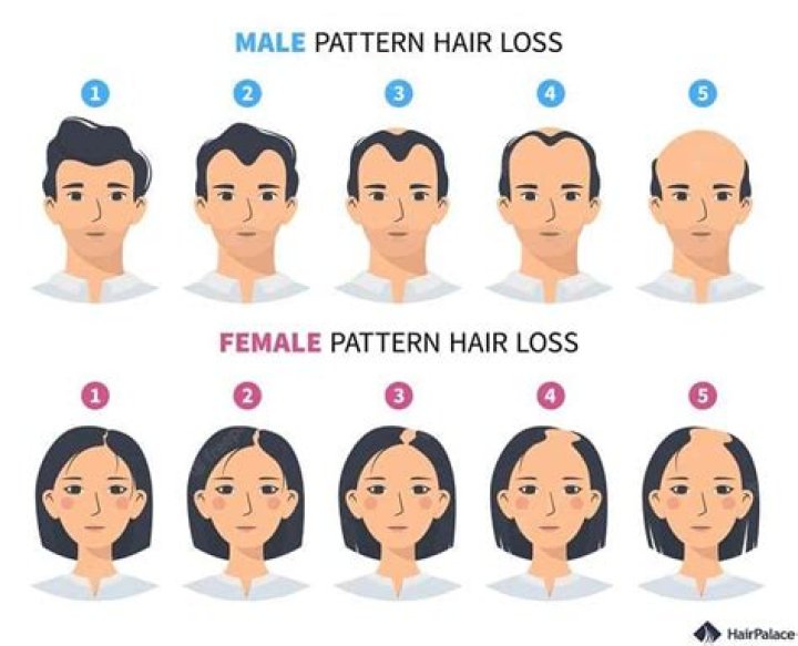 Could hormones cause hair loss?
