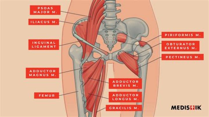 Did i injure my hip flexor?
