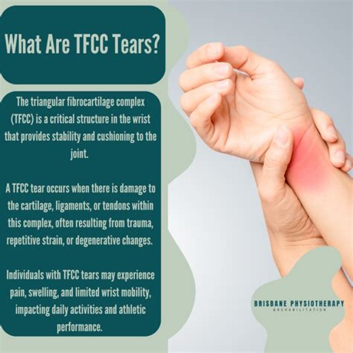 Do all tfcc tears require surgery?
