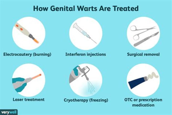 Do genital warts come and go?