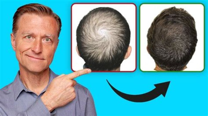 Do plucked hairs regrow?