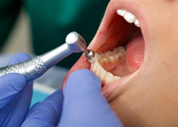 Do teeth cleanings hurt?