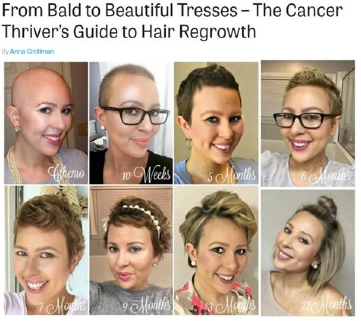 Does chemo always cause hair loss?