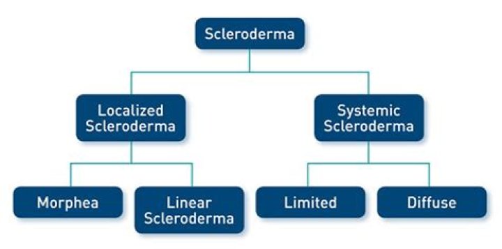 Does scleroderma cause fatigue?