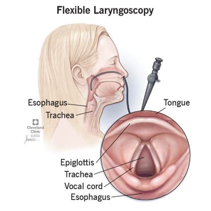 During indirect laryngoscopy we can see?