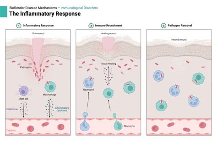During the inflammatory response rubor is a result of?