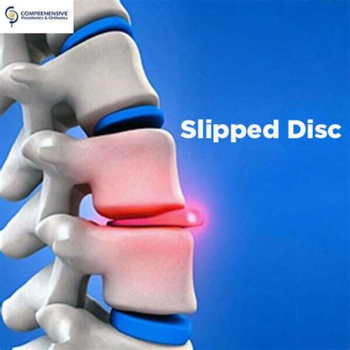 Has a slipped disc?