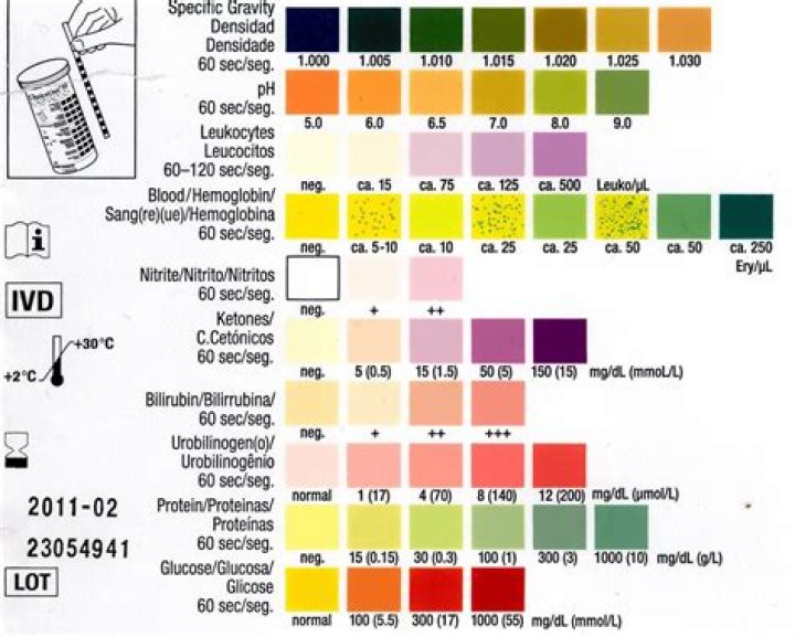 How long does a urinalysis take to get results?