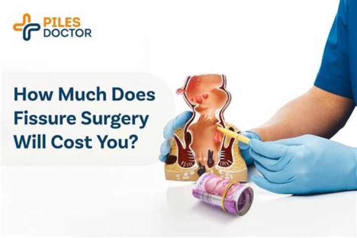 How much is fissure surgery?