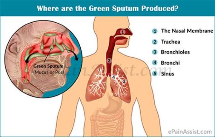 How sputum produced in body?