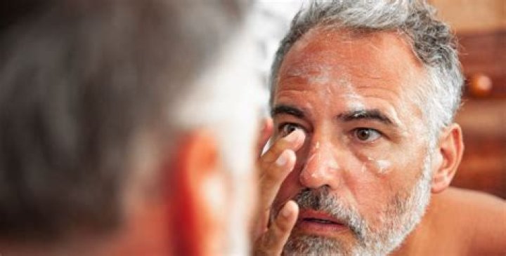 How to take care of a sunburn plant?