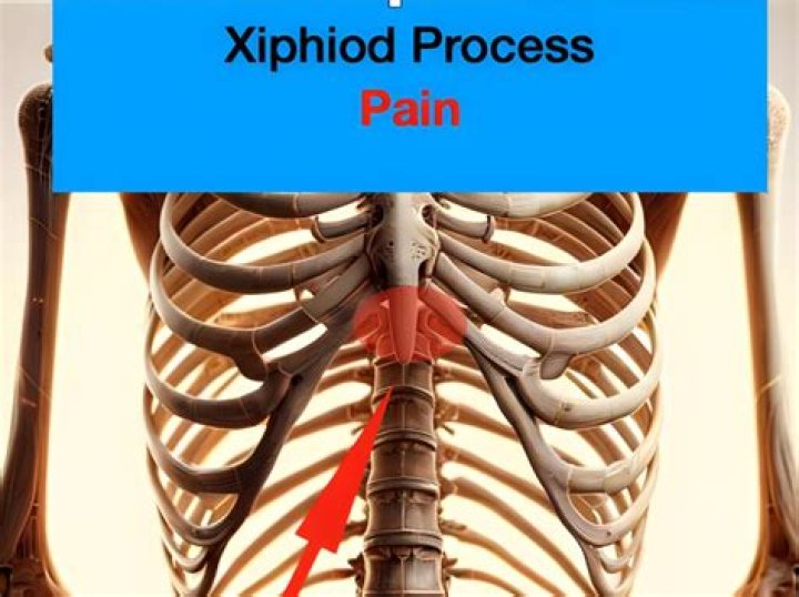 How to treat a broken xiphoid process?
