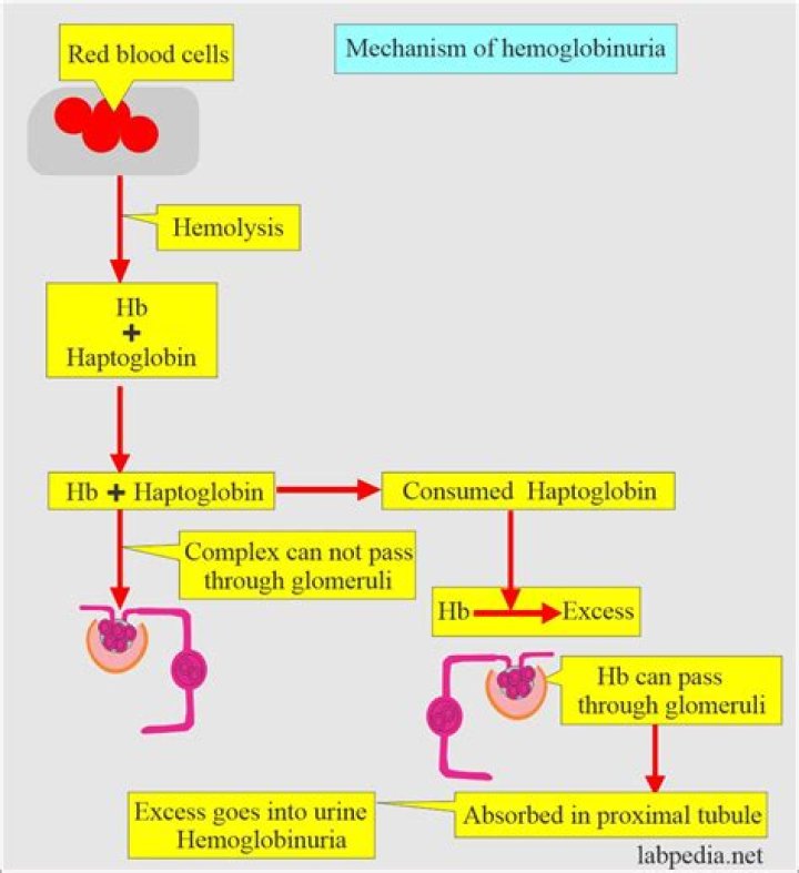 How to treat myoglobinuria?