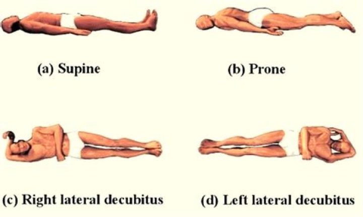 Is lateral decubitus position?