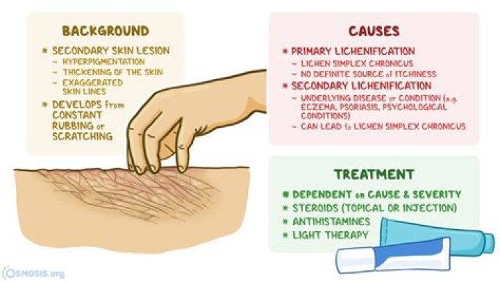 Is lichenification a word?