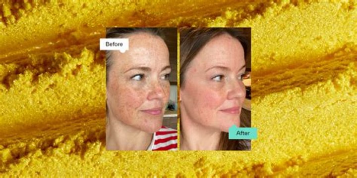 Is retinol cream yellow?