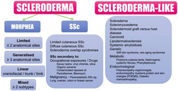 Is systemic sclerosis the same as scleroderma?