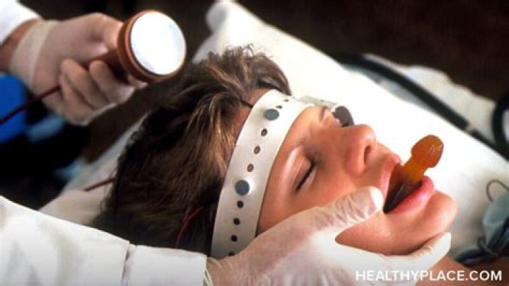 Should ect be used to treat depression?