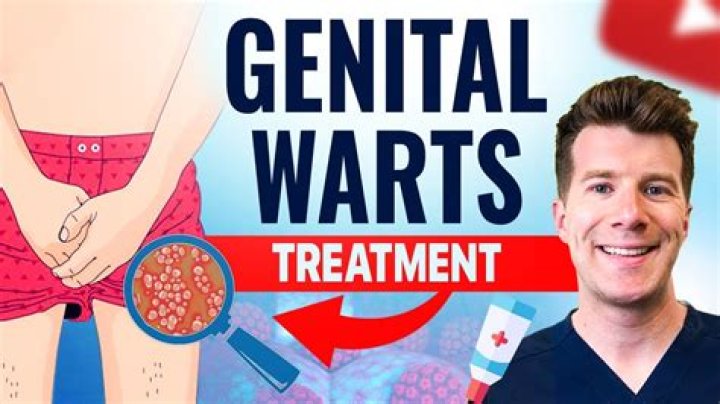 Should i be embarrassed about genital warts?