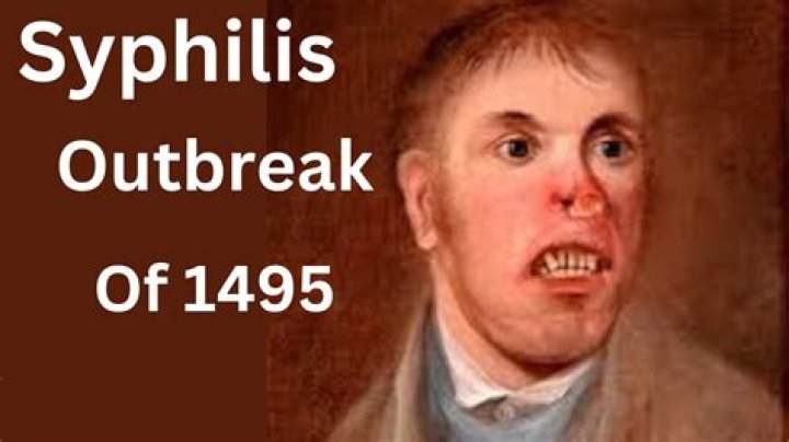 Was syphilis curable in the 1800's?