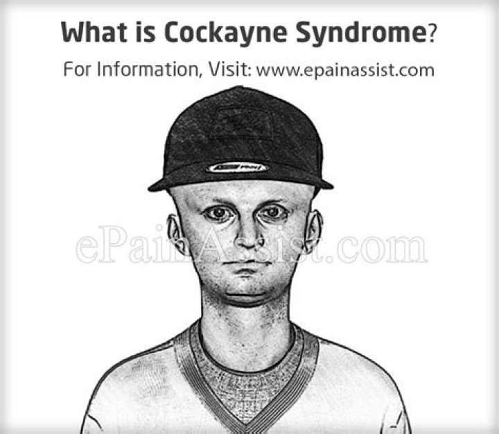 What causes cockayne syndrome?
