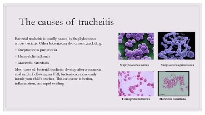 What causes tracheitis in child?