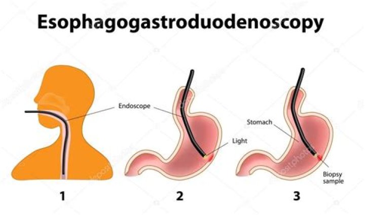 What does a esophagoscopy do?