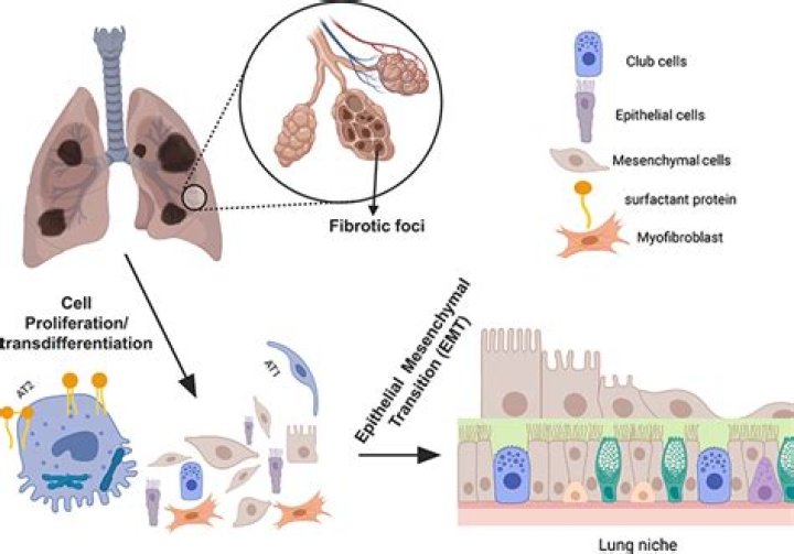 What does bleomycin do to the lungs?