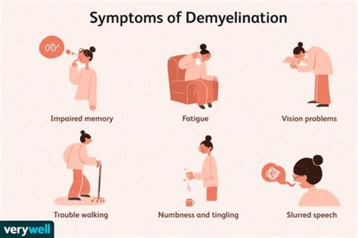 What does demyelination mean?