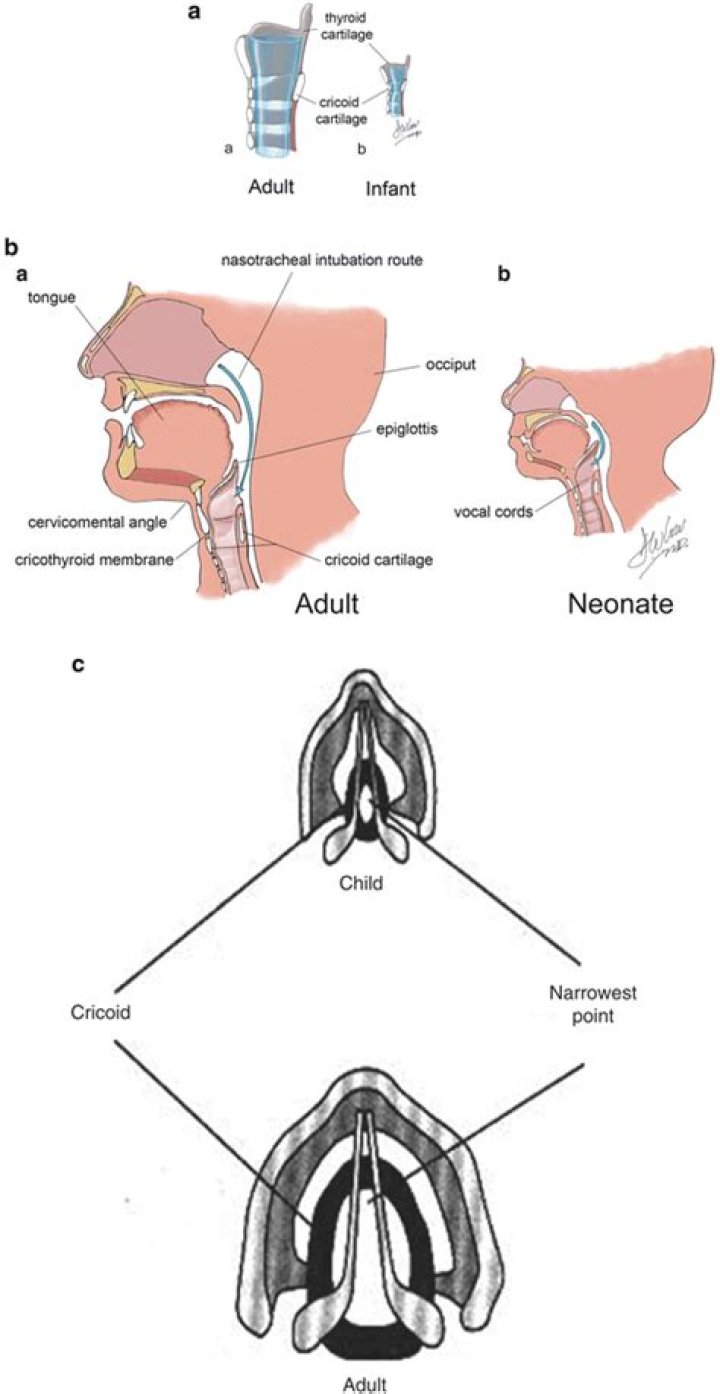 What does glottalized mean?