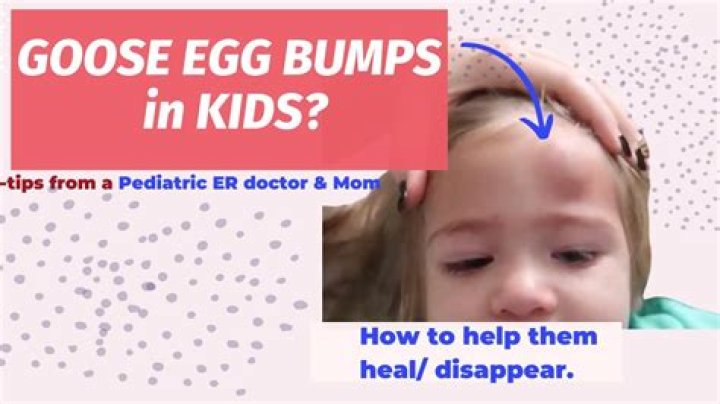 What does goose pimple stand for?