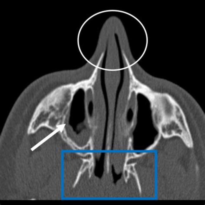 What does otorhinolaryngological mean?