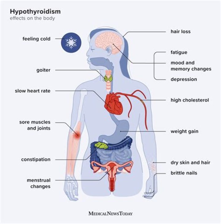 What does underactive thyroid do to your body?