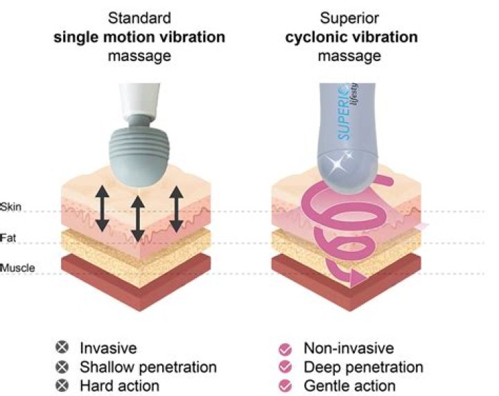 What is cycloid vibration therapy?