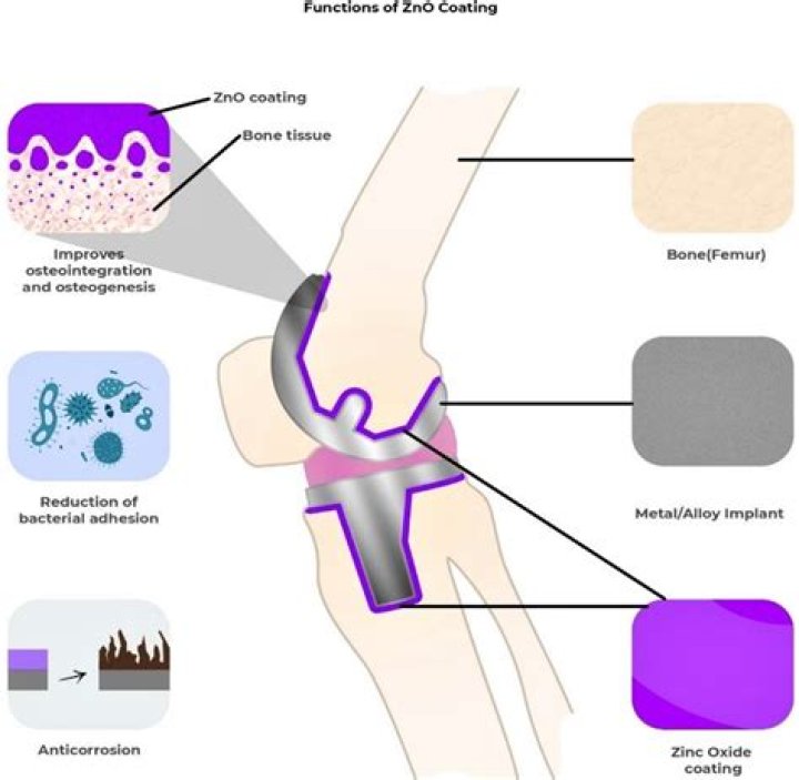 What is meant by collapsibility?