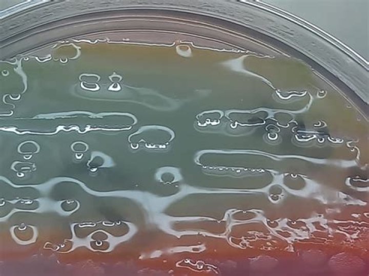 What is ozaena meaning?