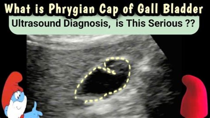 What is phrygian cap?